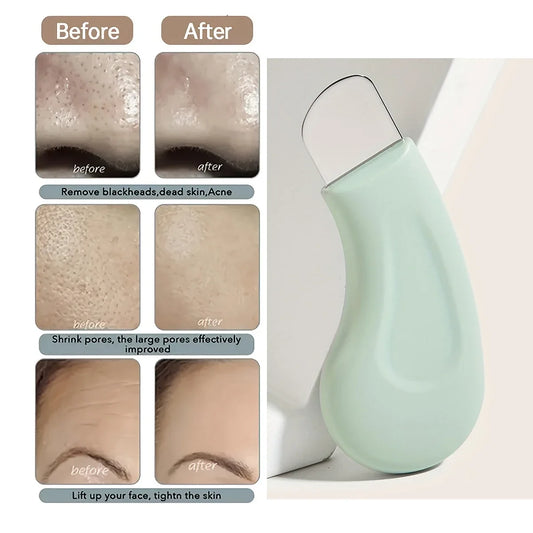 Blackhead and Whitehead Removal Tool for Nose and Face Pore Cleaner Skin Care for Women