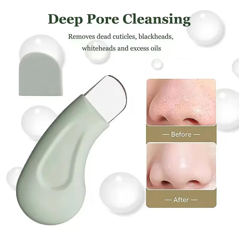 Blackhead and Whitehead Removal Tool for Nose and Face Pore Cleaner Skin Care for Women